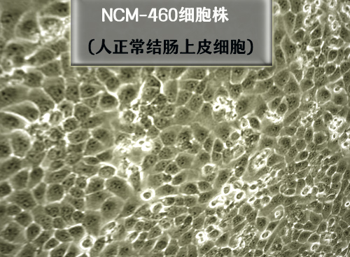 NCM460細胞