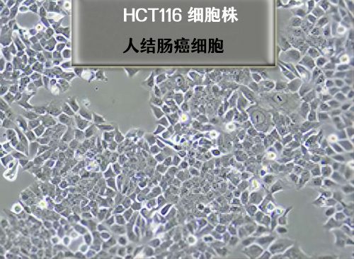 人結(jié)腸癌細胞HCT116??