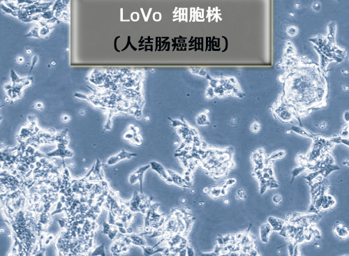 LoVo細胞