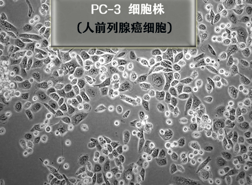 PC-3細胞