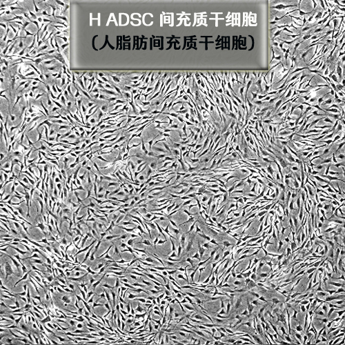 間充質(zhì)干細(xì)胞的特點(diǎn)及應(yīng)用經(jīng)驗(yàn)分享