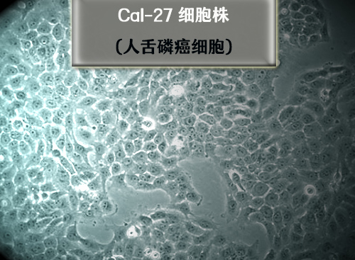 Cal-27細胞